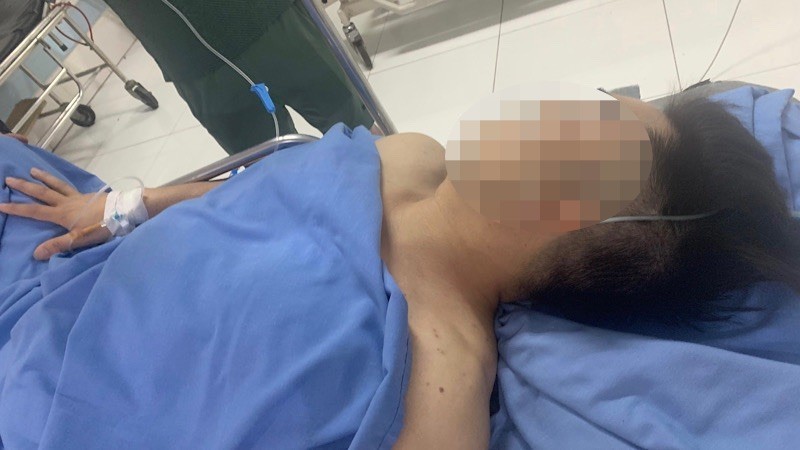 Đối tượng vi phạm nồng độ cồn đâm trọng thương một cảnh sát giao thông