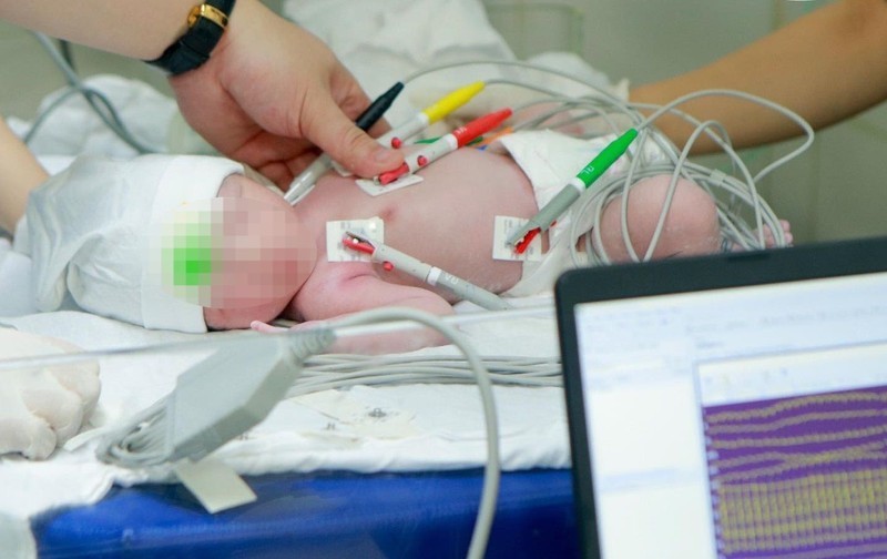 Cứu trẻ mắc tim bẩm sinh nặng ngay từ khi chào đời