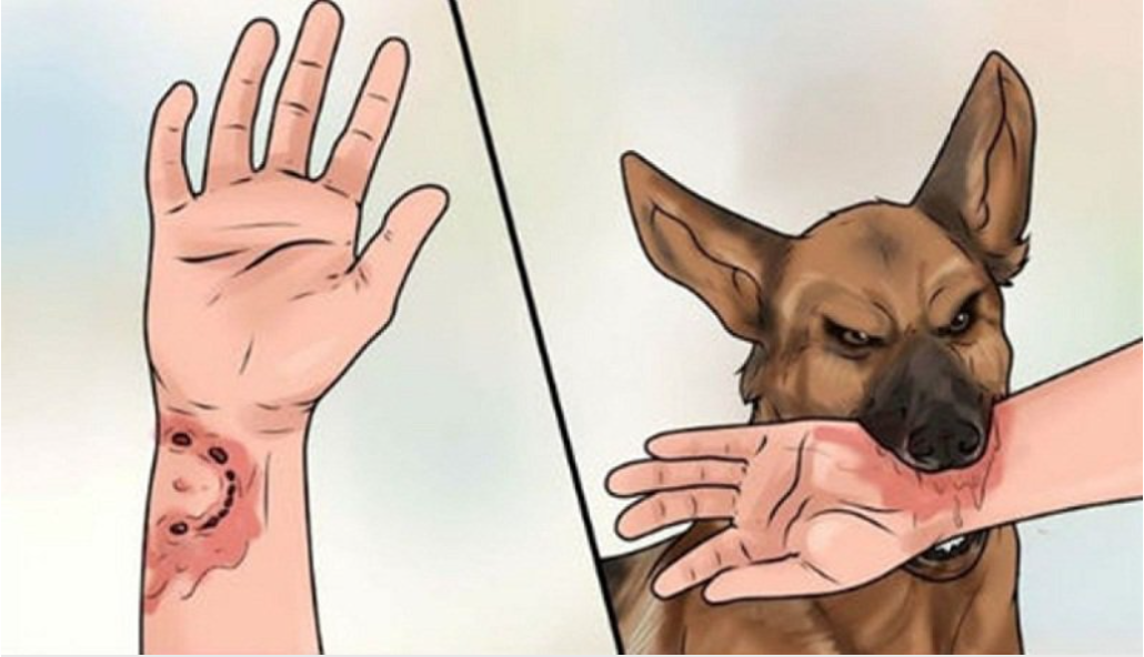 Bệnh dại tăng đột biến, Bộ Y tế khuyến cáo