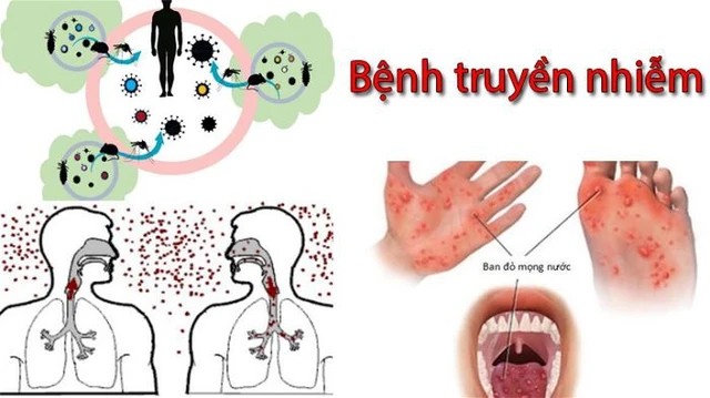 Nhiều bệnh truyền nhiễm đang có xu hướng gia tăng